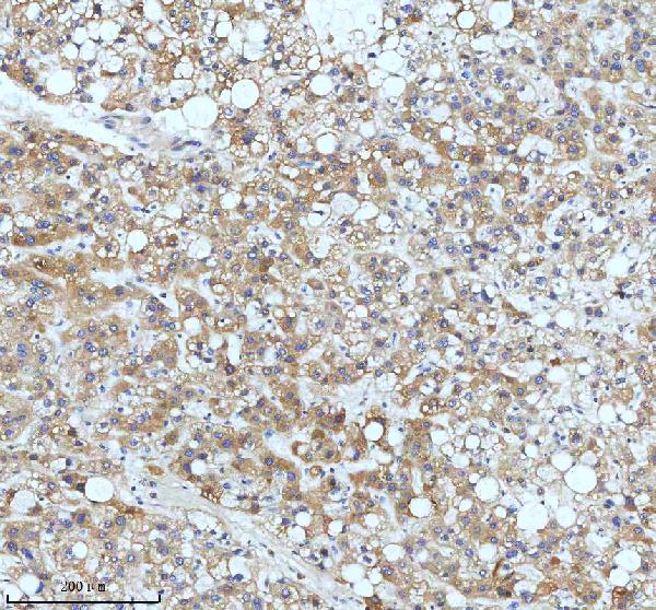 2 - Anti-Cyclin B2 CCNB2 Rabbit Monoclonal Antibody ABO13990