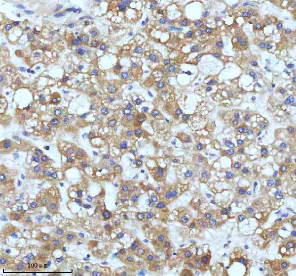 2 - Anti-Cyclin B2 CCNB2 Rabbit Monoclonal Antibody ABO13990