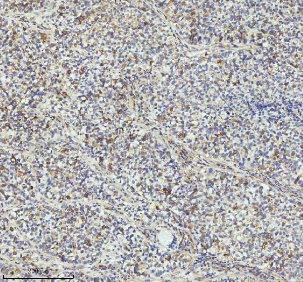 2 - Anti-Cyclin B2 CCNB2 Rabbit Monoclonal Antibody ABO13990