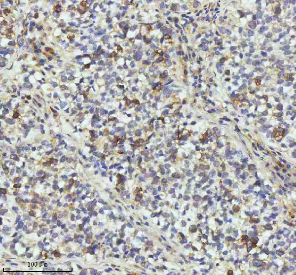 2 - Anti-Cyclin B2 CCNB2 Rabbit Monoclonal Antibody ABO13990