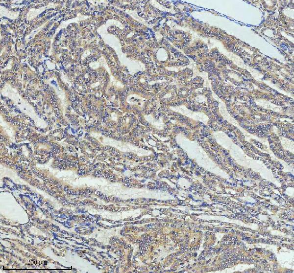 2 - Anti-Cyclin B2 CCNB2 Rabbit Monoclonal Antibody ABO13990