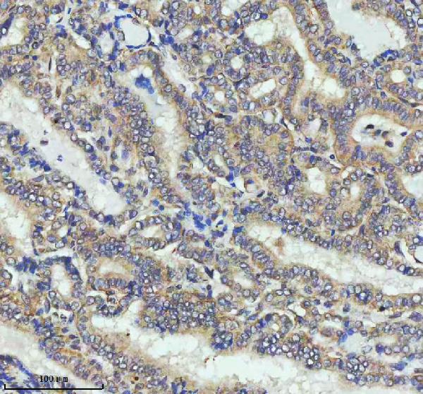 2 - Anti-Cyclin B2 CCNB2 Rabbit Monoclonal Antibody ABO13990