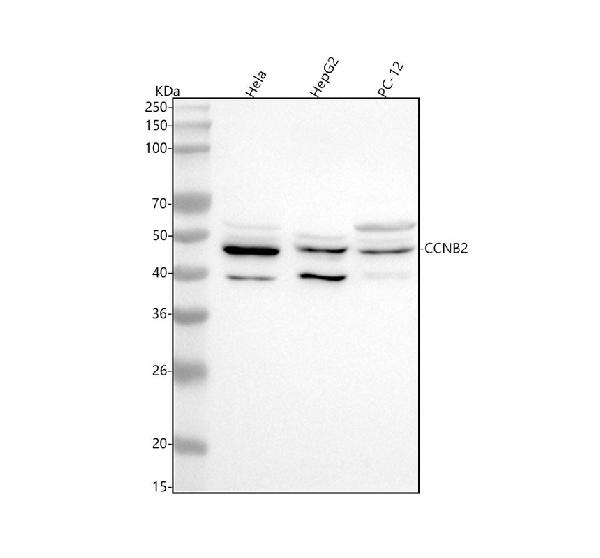 1 - Anti-Cyclin B2 CCNB2 Rabbit Monoclonal Antibody ABO13990