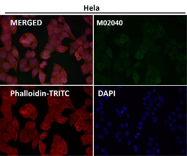 1 - Anti-Cyclin B2 CCNB2 Rabbit Monoclonal Antibody ABO13990