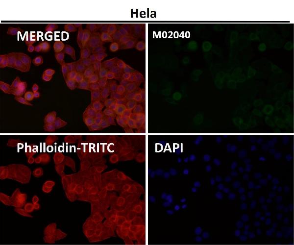 1 - Anti-Cyclin B2 CCNB2 Rabbit Monoclonal Antibody ABO13990