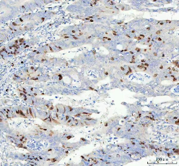 2 - Anti-Cyclin A2 Rabbit Monoclonal Antibody ABO13991