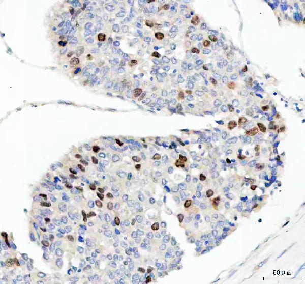 2 - Anti-Cyclin A2 Rabbit Monoclonal Antibody ABO13991