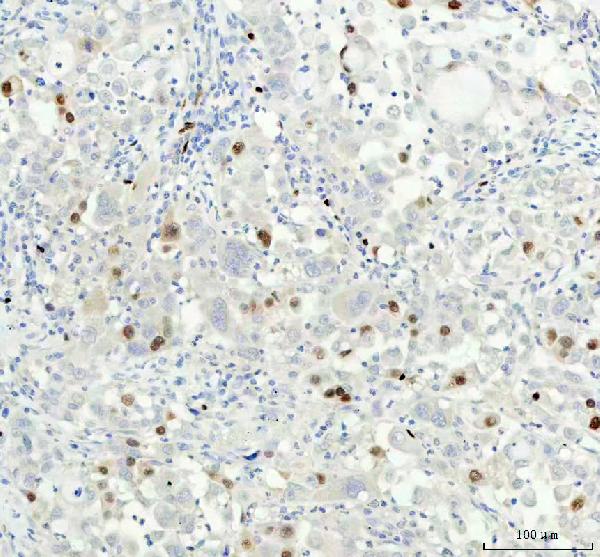 2 - Anti-Cyclin A2 Rabbit Monoclonal Antibody ABO13991