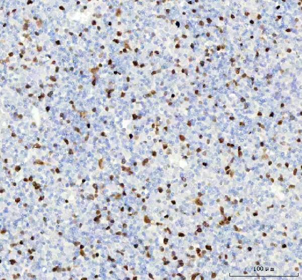 2 - Anti-Cyclin A2 Rabbit Monoclonal Antibody ABO13991