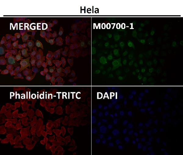 1 - Anti-Cyclin A2 Rabbit Monoclonal Antibody ABO13991