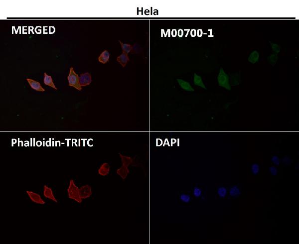 1 - Anti-Cyclin A2 Rabbit Monoclonal Antibody ABO13991