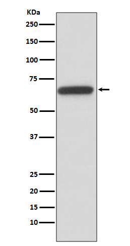 1 - Anti-HNF1 beta Rabbit Monoclonal Antibody ABO13992