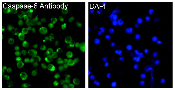 3 - Anti-Caspase-6 CASP6 Rabbit Monoclonal Antibody ABO13993