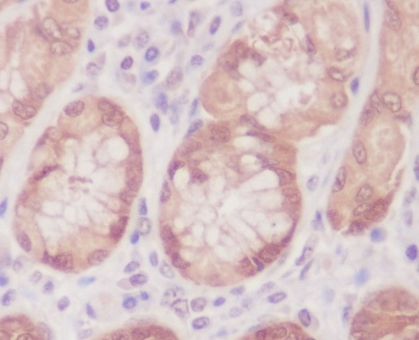2 - Anti-Caspase-6 CASP6 Rabbit Monoclonal Antibody ABO13993