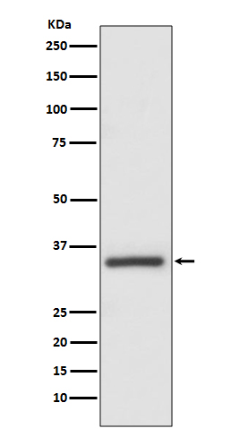1 - Anti-Caspase-6 CASP6 Rabbit Monoclonal Antibody ABO13993