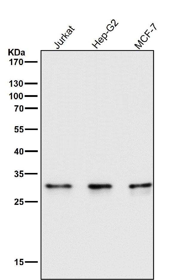 1 - Anti-Caspase-6 CASP6 Rabbit Monoclonal Antibody ABO13993