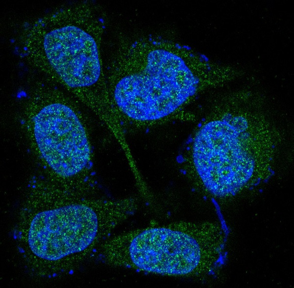 3 - Anti-MEK3/MEK6 MAP2K3 Rabbit Monoclonal Antibody ABO13994