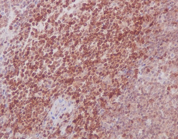 2 - Anti-MEK3/MEK6 MAP2K3 Rabbit Monoclonal Antibody ABO13994