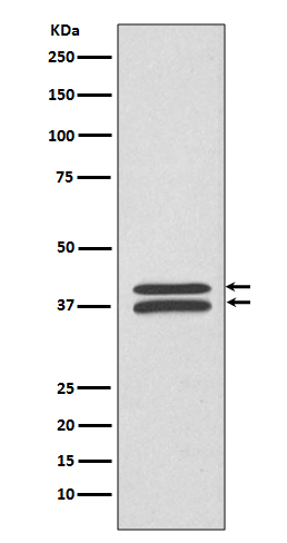 1 - Anti-MEK3/MEK6 MAP2K3 Rabbit Monoclonal Antibody ABO13994