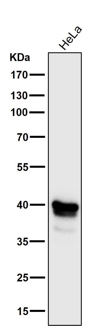 1 - Anti-MEK3/MEK6 MAP2K3 Rabbit Monoclonal Antibody ABO13994