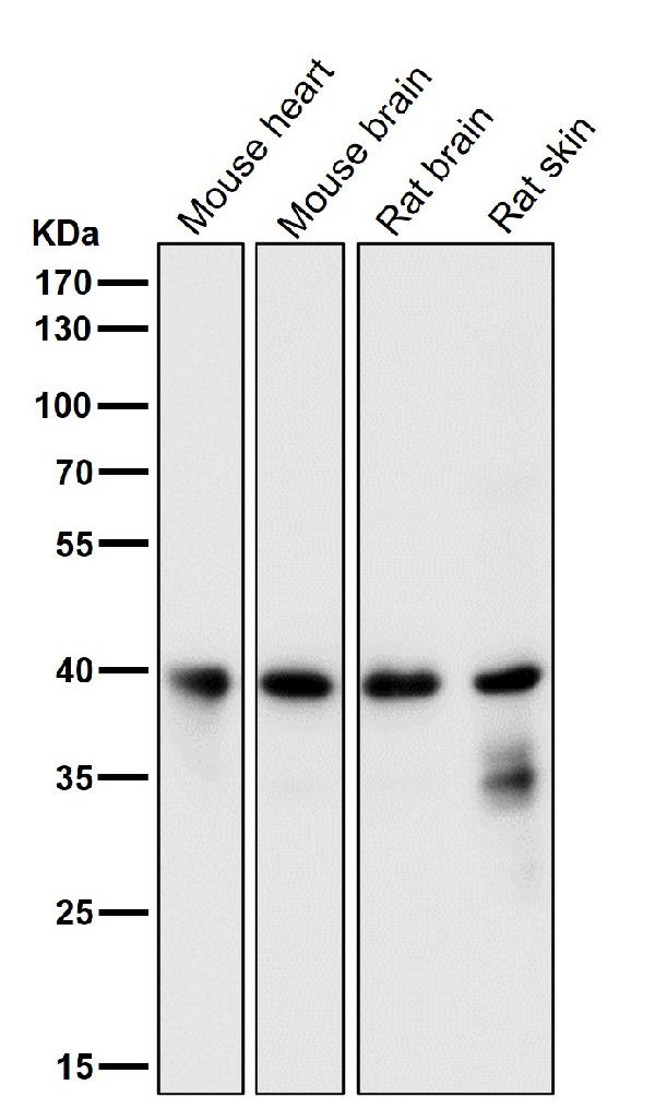1 - Anti-MEK3/MEK6 MAP2K3 Rabbit Monoclonal Antibody ABO13994