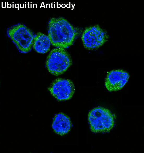 3 - Anti-Ubiquitin UBB Rabbit Monoclonal Antibody ABO13995