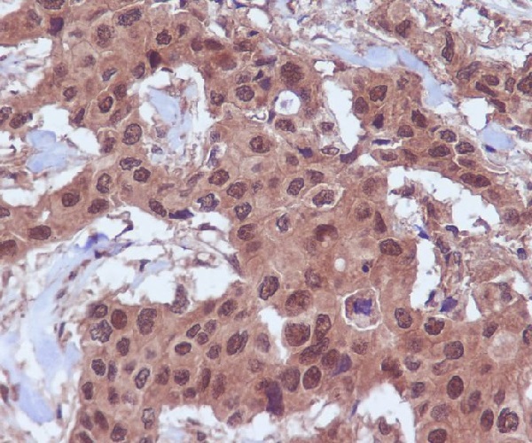 2 - Anti-Ubiquitin UBB Rabbit Monoclonal Antibody ABO13995