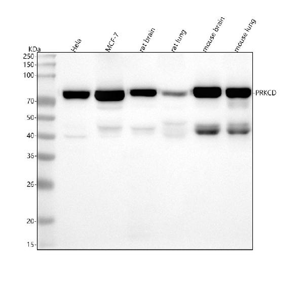 1 - Anti-PKC delta PRKCD Rabbit Monoclonal Antibody ABO13998