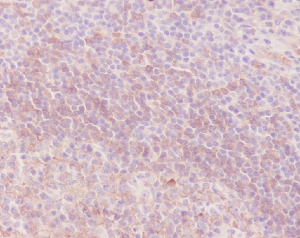 2 - Anti-Human IgM IGHM Rabbit Monoclonal Antibody ABO13999