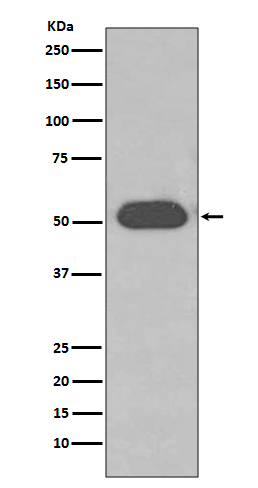 1 - Anti-GC / VDBP Rabbit Monoclonal Antibody ABO14000