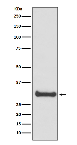 1 - Anti-Calbindin CALB1 Rabbit Monoclonal Antibody ABO14001