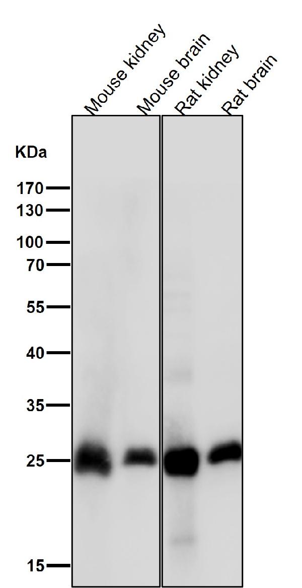 1 - Anti-Calbindin CALB1 Rabbit Monoclonal Antibody ABO14001