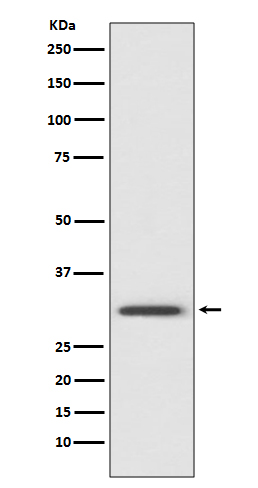 1 - Anti-Annexin V ANXA5 Rabbit Monoclonal Antibody ABO14002