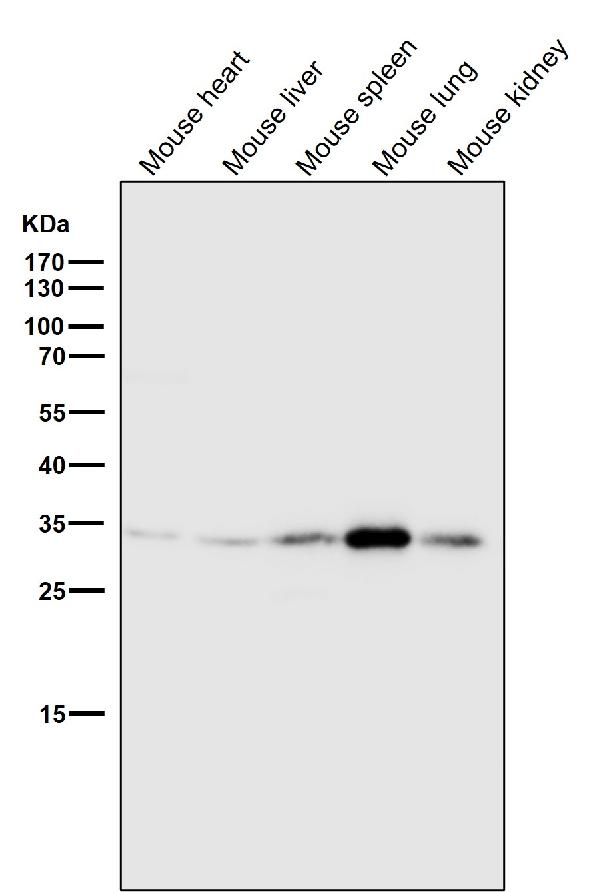 1 - Anti-Annexin V ANXA5 Rabbit Monoclonal Antibody ABO14002