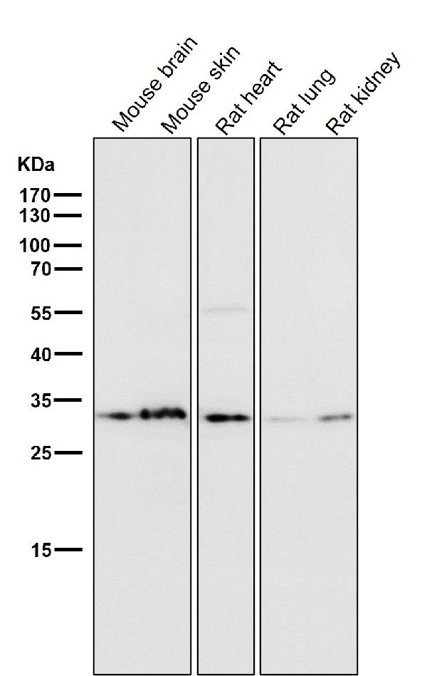 1 - Anti-Annexin V ANXA5 Rabbit Monoclonal Antibody ABO14002