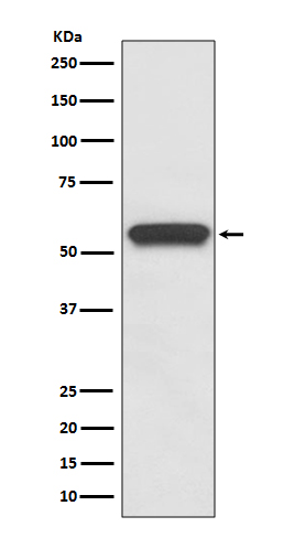 1 - Anti-Aromatase CYP19A1 Rabbit Monoclonal Antibody ABO14003