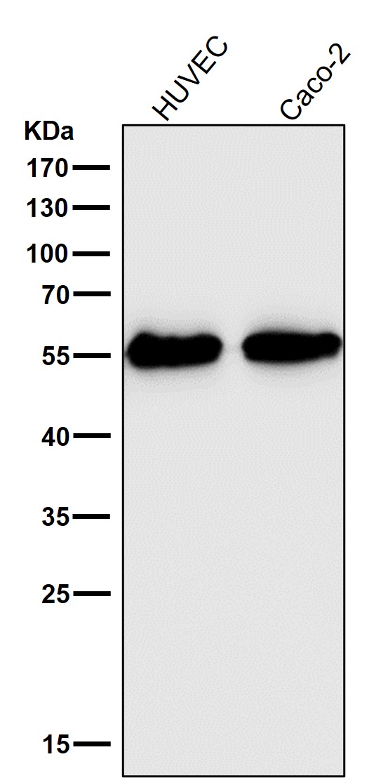 1 - Anti-Aromatase CYP19A1 Rabbit Monoclonal Antibody ABO14003