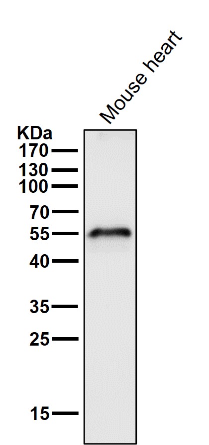 1 - Anti-Aromatase CYP19A1 Rabbit Monoclonal Antibody ABO14003