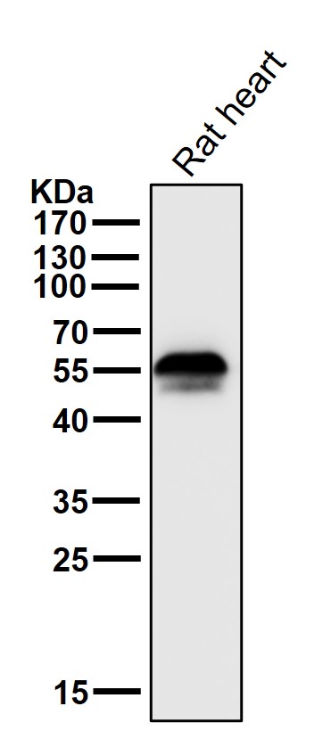 1 - Anti-Aromatase CYP19A1 Rabbit Monoclonal Antibody ABO14003