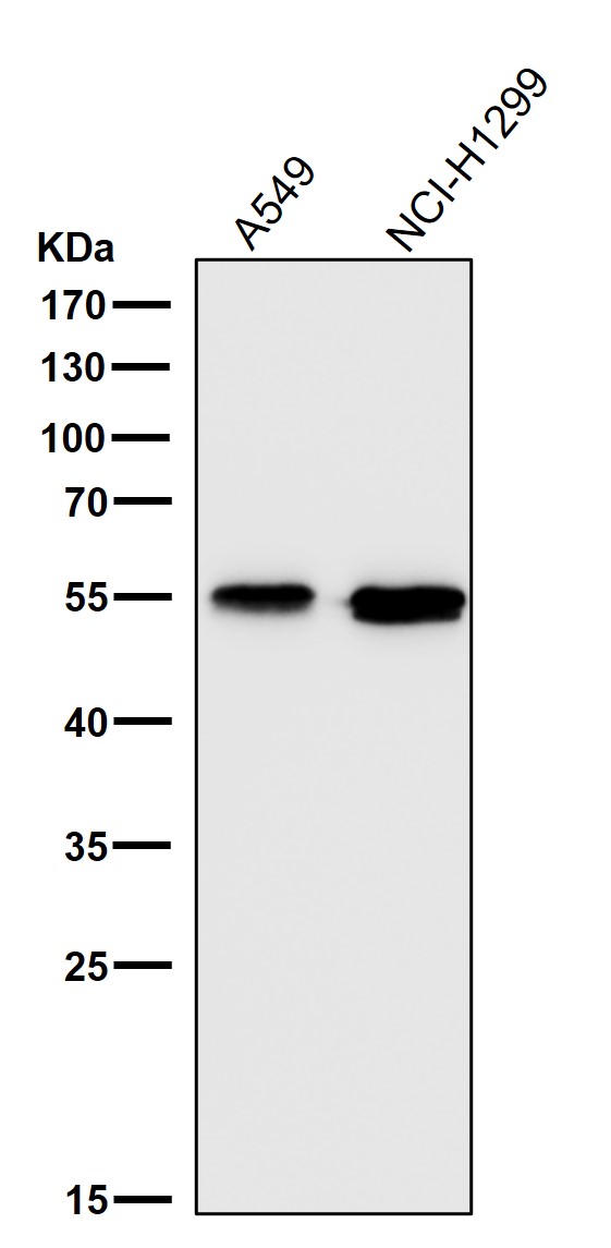 1 - Anti-Aromatase CYP19A1 Rabbit Monoclonal Antibody ABO14003