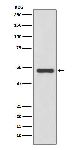 1 - Anti-Urokinase Rabbit Monoclonal Antibody ABO14004