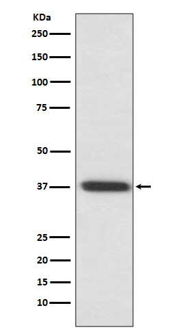 1 - Anti-Rhodopsin Rabbit Monoclonal Antibody ABO14005