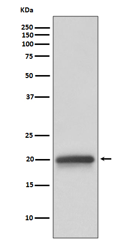 1 - Anti-Claudin 5 CLDN5 Rabbit Monoclonal Antibody ABO14006