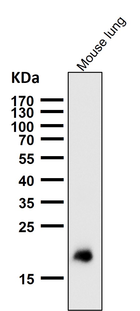 1 - Anti-Claudin 5 CLDN5 Rabbit Monoclonal Antibody ABO14006