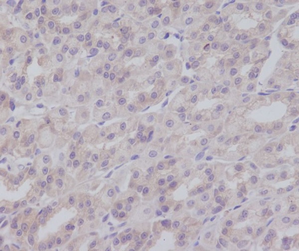 2 - Anti-IKK gamma IKBKG Rabbit Monoclonal Antibody ABO14007