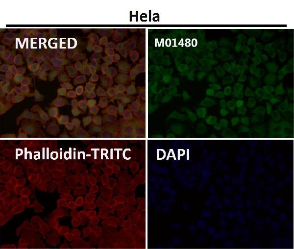 1 - Anti-Profilin1 PFN1 Rabbit Monoclonal Antibody ABO14008
