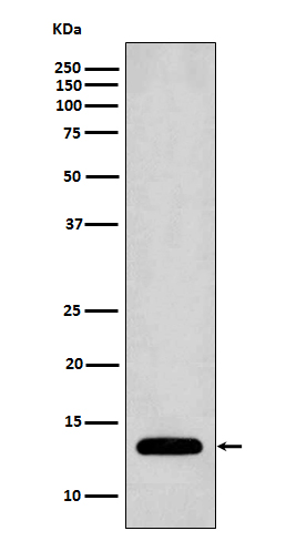 1 - Anti-Profilin1 PFN1 Rabbit Monoclonal Antibody ABO14008