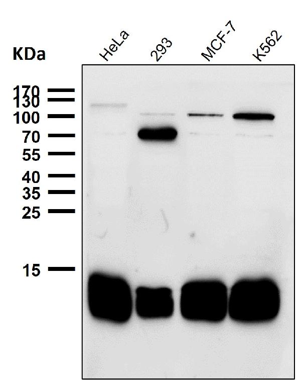 1 - Anti-Profilin1 PFN1 Rabbit Monoclonal Antibody ABO14008