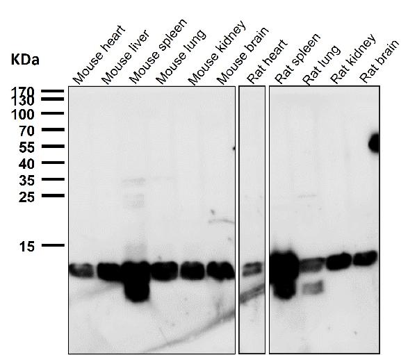 1 - Anti-Profilin1 PFN1 Rabbit Monoclonal Antibody ABO14008