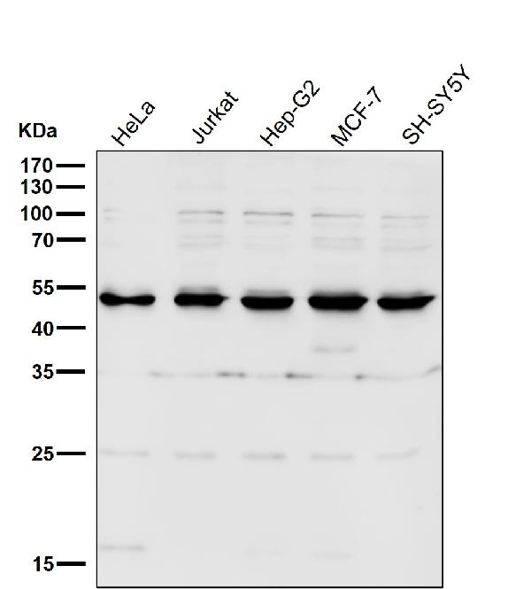 1 - Anti-LXR alpha NR1H3 Rabbit Monoclonal Antibody ABO14009